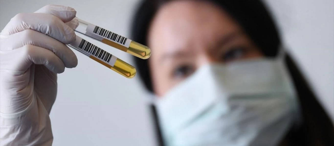 Ενθαρρυντικά τα πρώτα αποτελέσματα της κολχικίνης σε 60 Έλληνες ασθενείς με κορωνοϊό